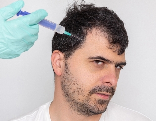 Man with short, dark hair looking skeptical as a syringe, held by a hand in a light blue glove, is poised near his head, suggesting a medical or cosmetic procedure, against a neutral background, conveying themes of hair restoration or cosmetic treatment.